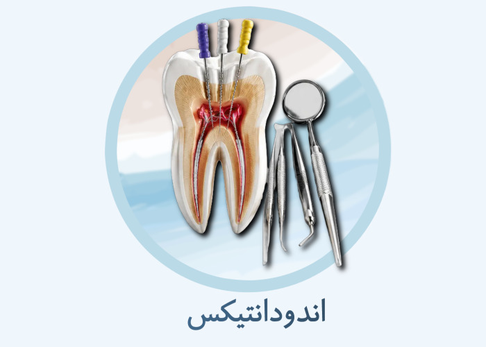 اقلام اندودانتیکس