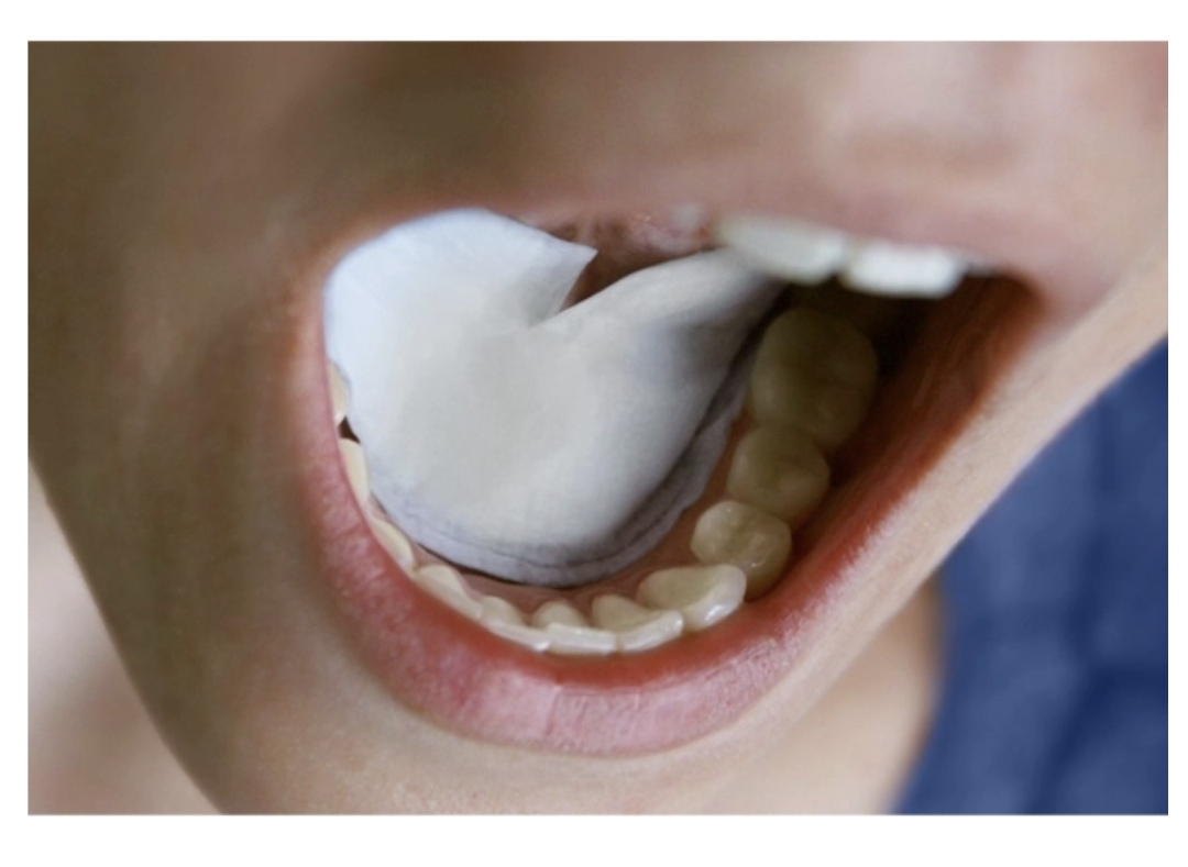 پد زیر زبانی کنترل کننده بزاق