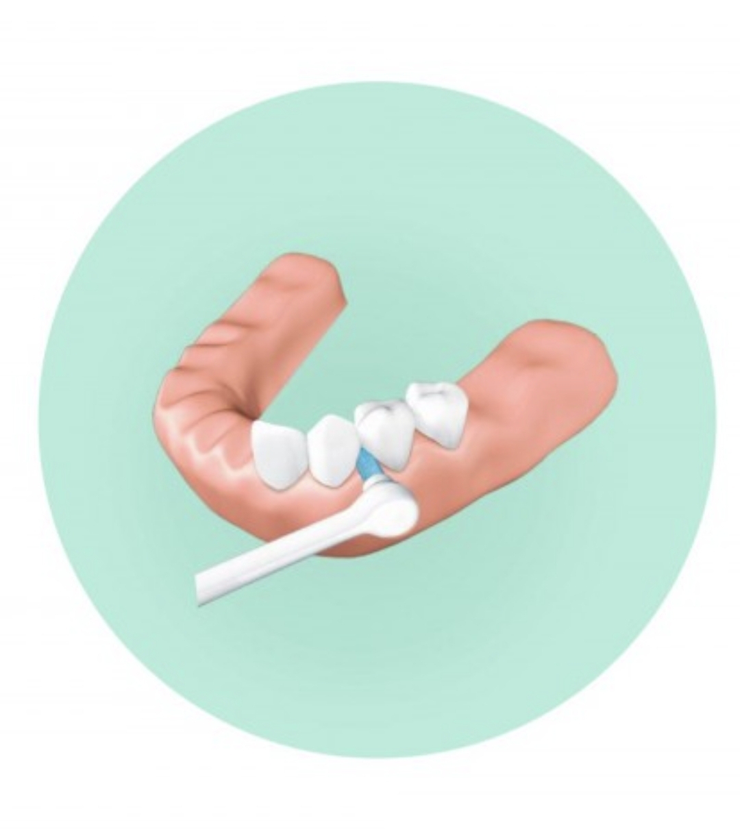 مسواک پرسیژن اند ایمپلنت کلین