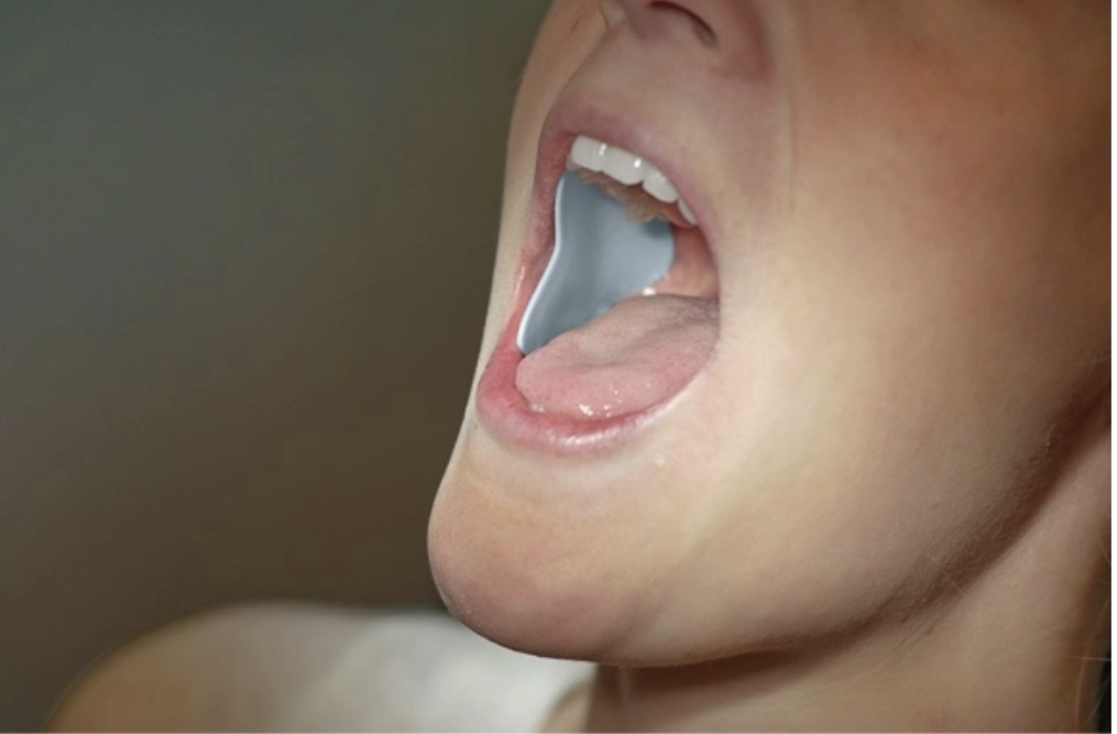 پد کنترل کننده غدد بزاقی - پاروتید